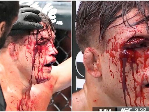 Drew Dober suffers one of the most gruesome cuts in UFC history - it was so gory it's gone viral