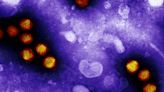 CDC to investigate whether adenovirus is ‘incidental’ in children with mysterious hepatitis