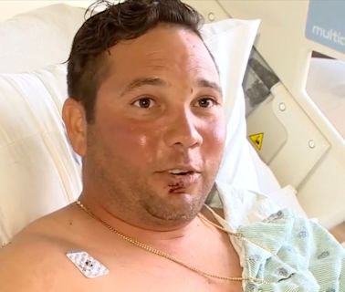 Fisherman ‘lucky to be alive’ after being attacked by bull shark in front of his children