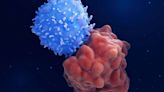 CAR-T Plus Stem-Cell Transplant Promising for CD7+ Blood Cancers