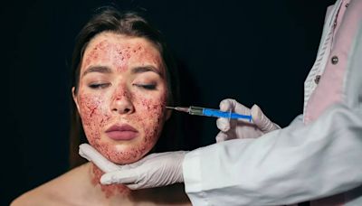 All about Vampire Facial, beauty treatment that left 3 women infected with HIV - Times of India