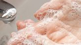洗碗不帶手套就會有「主婦手」！？「主婦手」會傳染性嗎？病情嚴重會出現手部紅腫、脫皮情況！