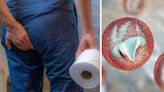 Urgent diarrhoea bug warning as new 'parasite hotspots' found across UK