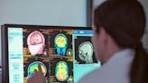 Council Post: Early Detection Of Alzheimer’s May (Only Now) Be The Next Big Opportunity In Diagnostics