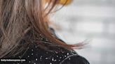 Can washing your hair regularly for 21 days keep dandruff away?