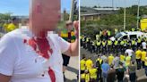 Leeds fan 'slashed in neck' outside Carrow Road after Norwich play-off semis