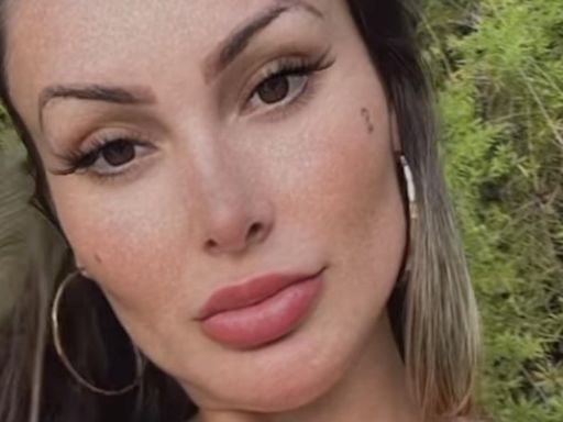 Andressa Urach mostra sua cintura após remover as costelas