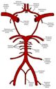 Labyrinthine artery