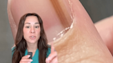 Dermatologist Shares "Nail Sign You Should Never Ignore" in New Video