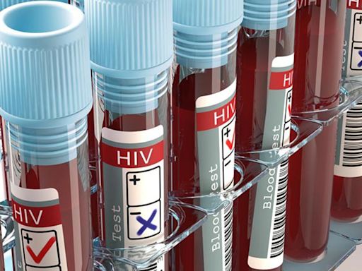 Tripura on high alert after HIV spread: How are students falling victim to the deadly virus?