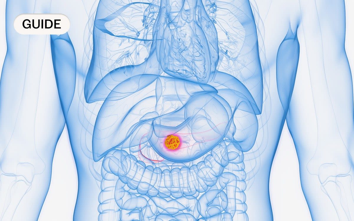 Pancreatic cancer: Symptoms, causes and treatment