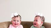 Formerly conjoined twins, Ella and Eliza, are thriving on their 1st birthday