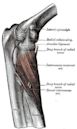 Radial tunnel syndrome