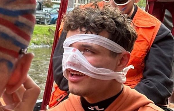 Lando Norris suffers nasty facial injury while partying in Amsterdam before Miami Grand Prix