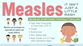 Measles cases on the rise around the world, in the US. Duke & UNC doctors on staying safe