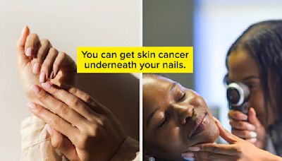 Dermatologists Who Had Skin Cancer Share 7 Warnings That Can Save Your Life