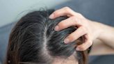 What Causes an Itchy Scalp—And How Do You Treat It?