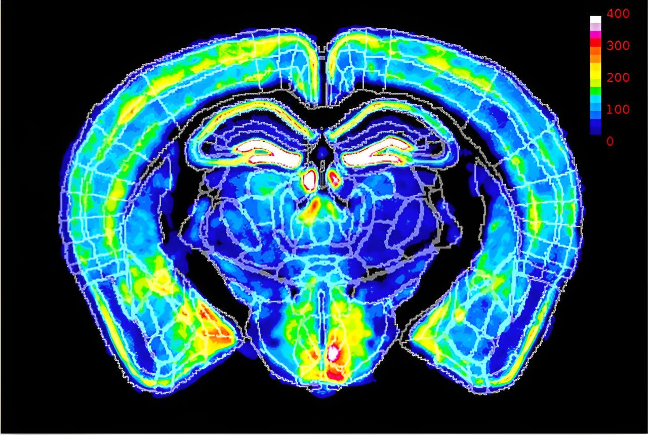 X-chromosome inactivation may reduce autism risk, study in mice suggests