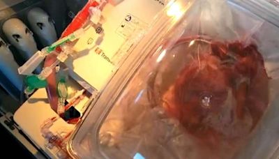 Heart transplants may soon be more accessible thanks to 'heart-in-a-box' tech