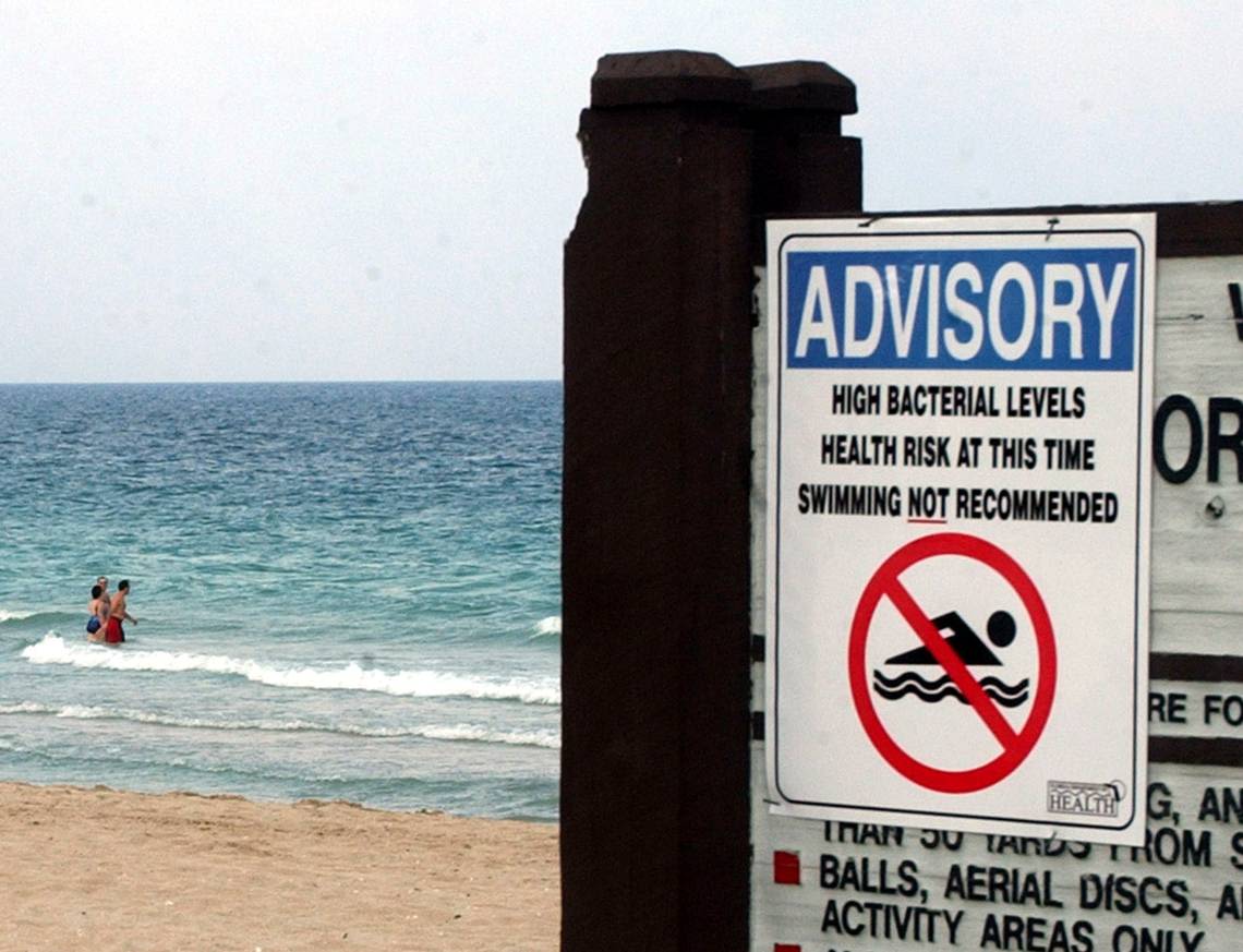 Don’t swim at these two popular Miami-area beaches, county health department says