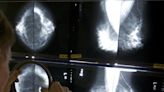 Mammograms should start earlier amid rising breast cancer rates, panel says