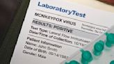 Ten new monkeypox cases reported in Massachusetts, says DPH