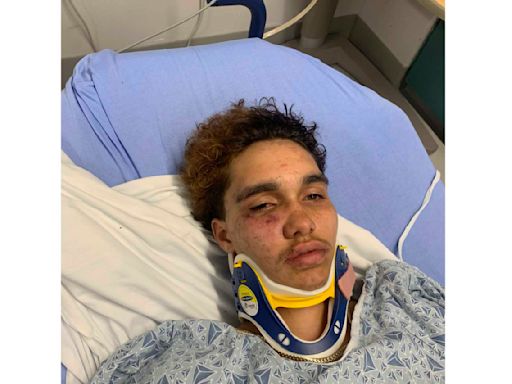 A transgender teen in Massachusetts says other high schoolers beat him at a party