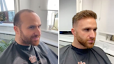 Man who suffered from hair loss gives confidence to others with ‘cure’ for baldness