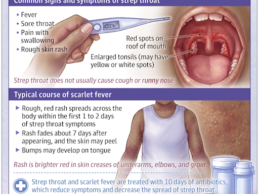 Patient Information: Strep Throat