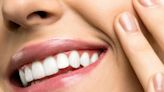 Los 3 alimentos que más perjudican la salud de los dientes