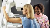 Q&A: Do you know your risks for breast cancer?