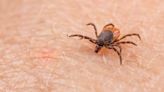 What Is Rocky Mountain Spotted Fever? CDC Issues New Health Alert