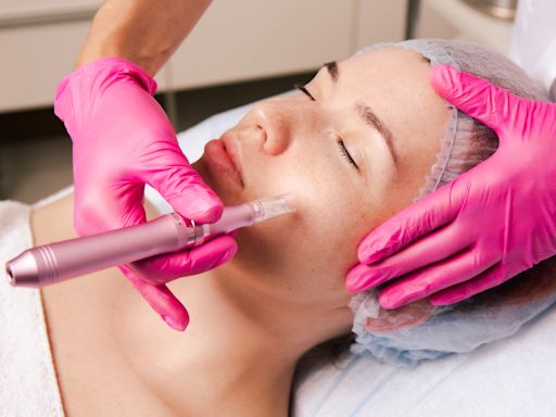 'Vampire facials' likely infected 3 women with HIV. Here's what health experts want you to know about these beauty treatments — and how to stay safe.