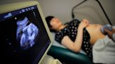 North Carolina Can Ban Most Abortions after 20 Weeks, Judge Rules