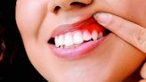 La Nación / Signos de dolor indican que debes acudir urgentemente al odontólogo