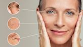 Facelift Without Surgery? Here Are The Treatments Experts Love