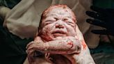 Prepare to Be Moved: Witness the Raw and Powerful Moments Captured in These 27 Award-Winning Birth Photos of 2023