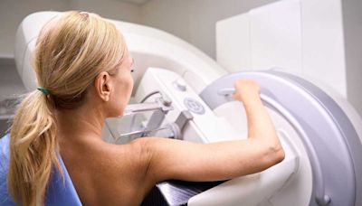 Mammograms are now recommended starting at age 40. Should you get one?