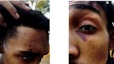 Memphis police officers who beat Tyre Nichols attacked Black veteran 3 days earlier, lawsuit alleges