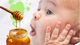 蜜糖可令嬰兒中毒？衞生署: 1歲前不應餵食