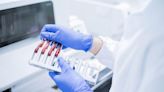 Blood test may improve detection of pancreatic cancers