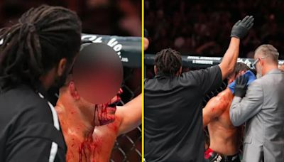 UFC fans offer rare praise to cageside doctor as sickening cut leads to stoppage