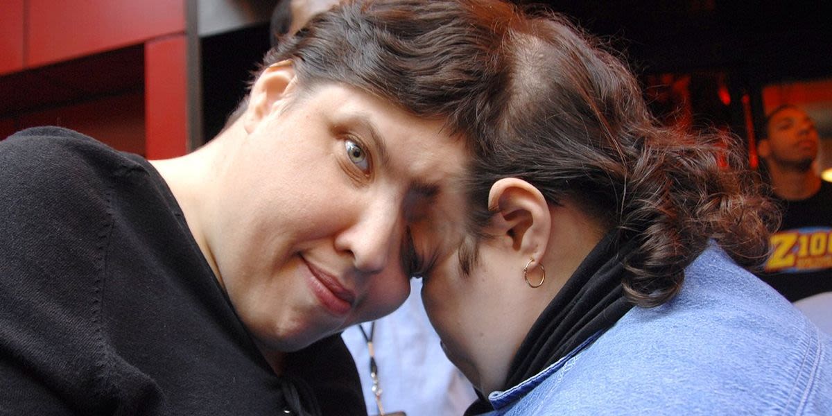 Conjoined twins Lori Schappell and trans man George Schappell dead at 62