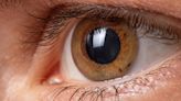 Corneas made from pig skin restore sight in humans: study