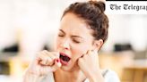 Ask Dr James: Why can’t I stop yawning?