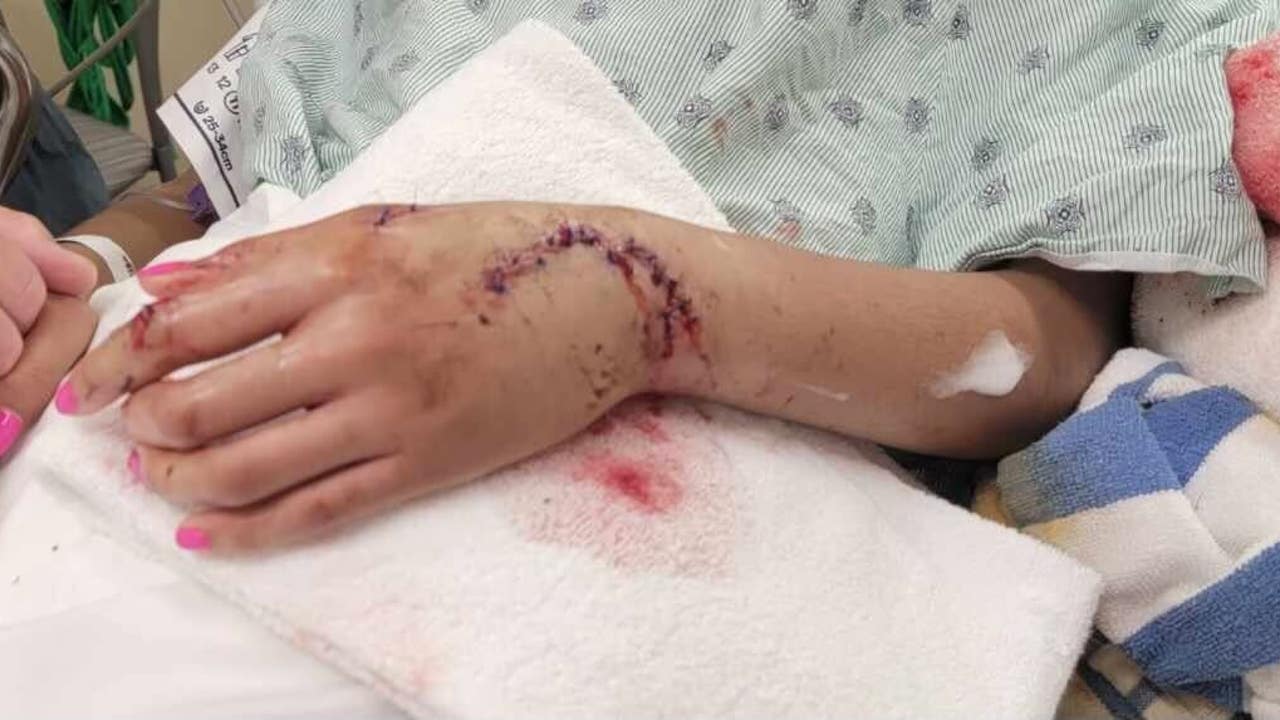 Shark at Galveston Beach bites teen, leaves severe injuries: 'I started punching it'