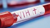Fármaco reduce a cero las infecciones de VIH en pruebas clínicas | Teletica
