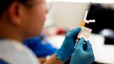 “Impresionante”: Resultados de ensayo de vacuna contra el melanoma entusiasman a médicos
