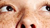 Freckles Are 'In' Now — And People Who Grew Up Hating Theirs Have Thoughts