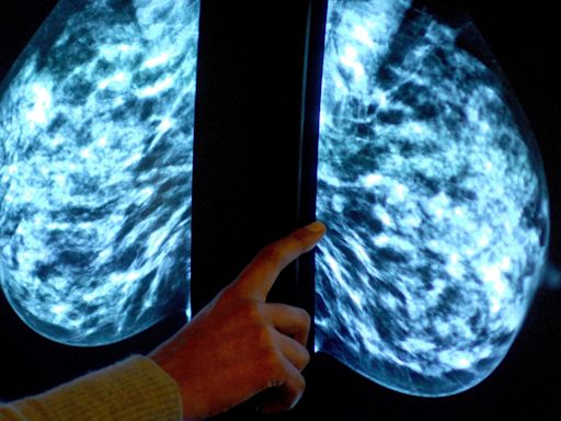 AI trained by London scientists may soon be able to detect cancer